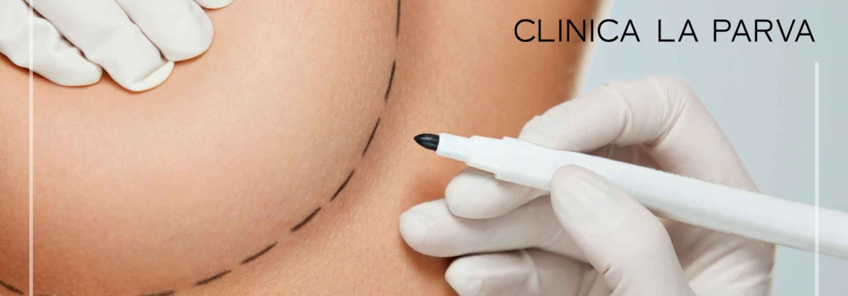 Aumento Mamario clinica la parva cirugia plastica