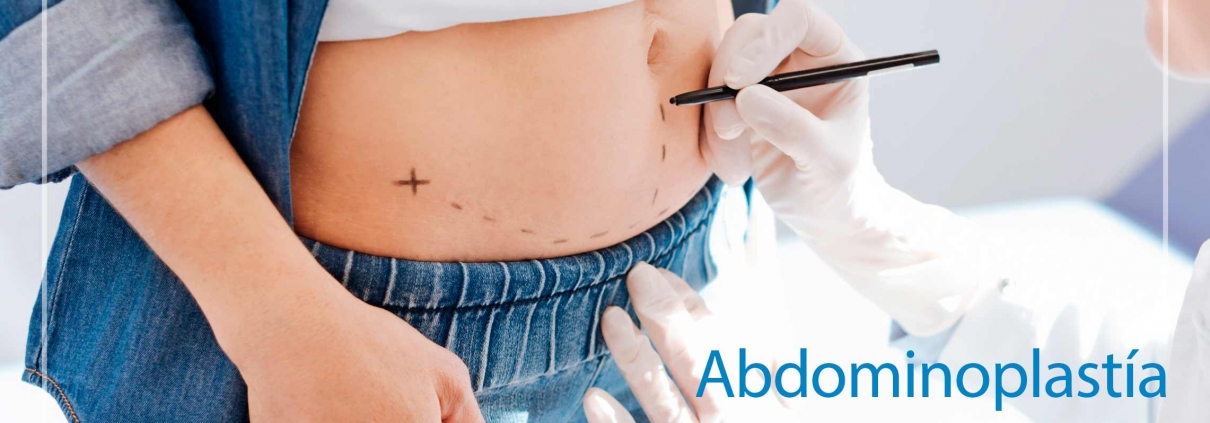 Abdominoplastia clinica la parva cirugia plastica
