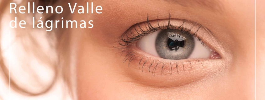 Relleno Valle de Lágrimas clínica la parva dermoestética