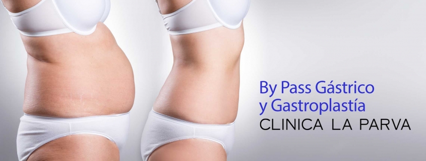 By Pass Gástrico y Gastroplastía Cirugía bariátrica Clínica La Parva