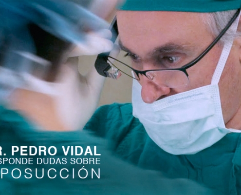 Dr. Pedro Vidal responde dudas sobre Liposucción cirugía plástica