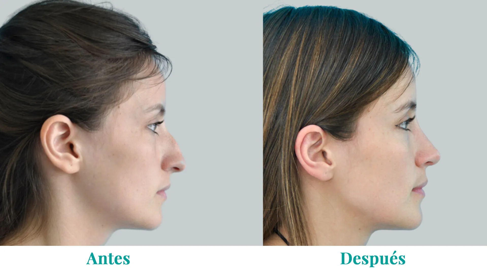 Banner_Caso1_Rino_converted