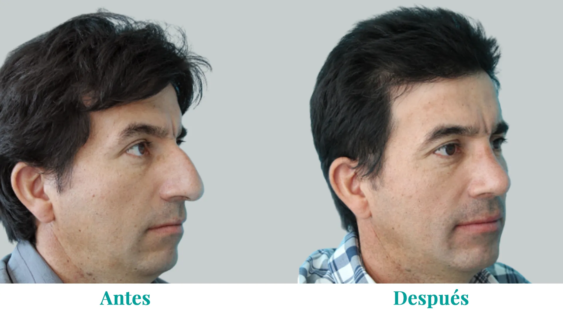 Banner_Caso2_Rino_converted