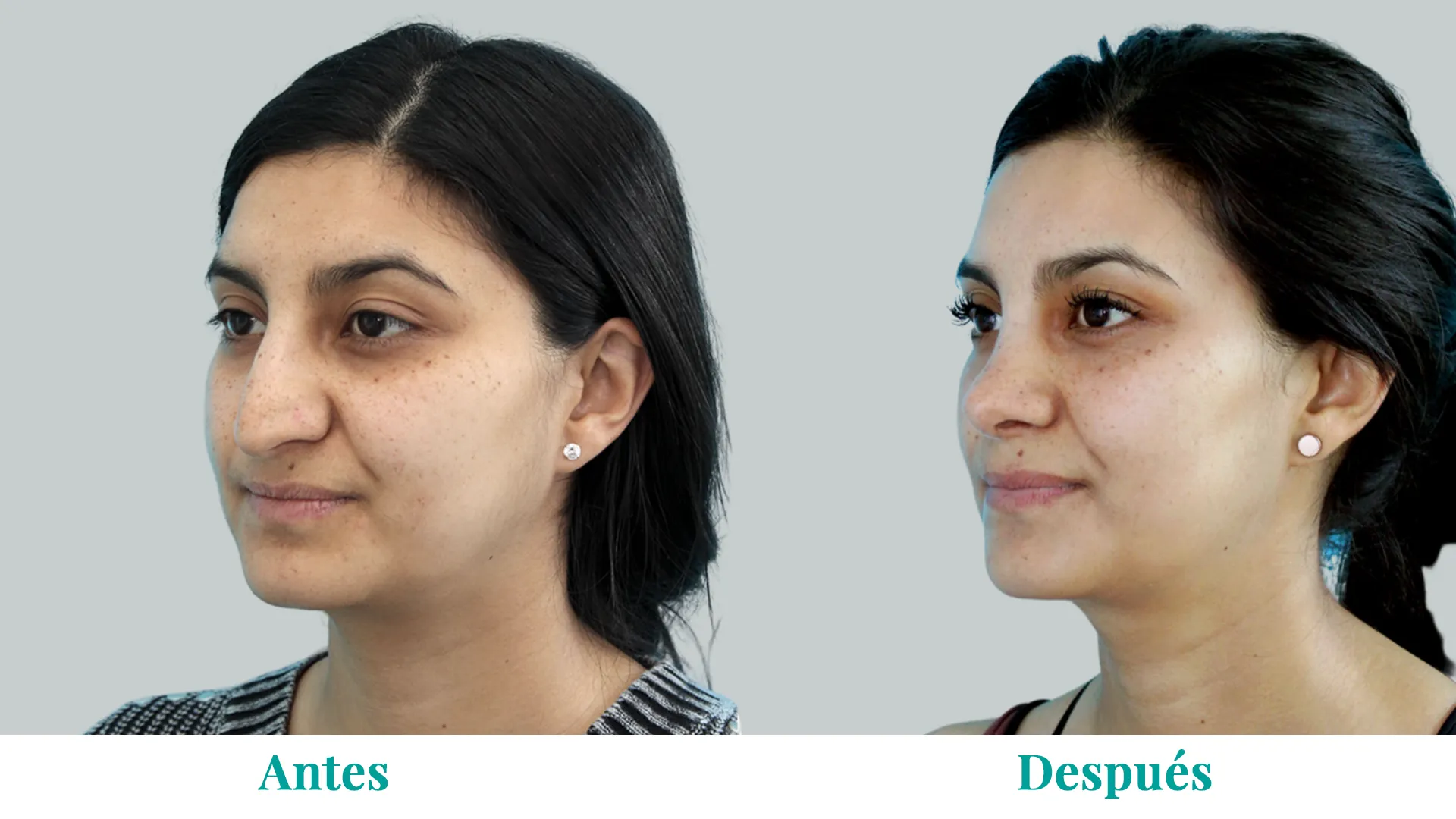 Banner_Caso3_Rino_converted