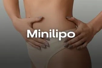 Minilipo-movil