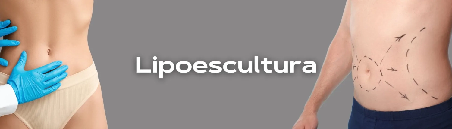 lipoescultura-banner_converted