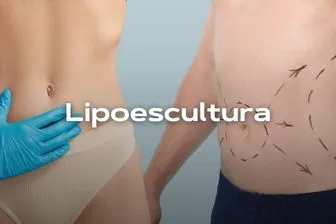 lipoescultura-movil_converted