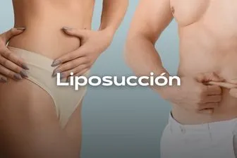 liposuccion-movil