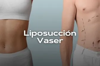 liposuccionvaser-movil