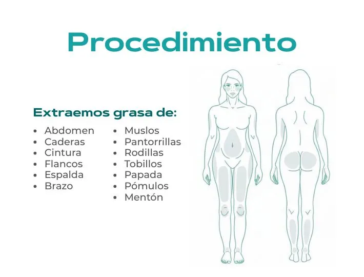procedimiento_lipoescultura